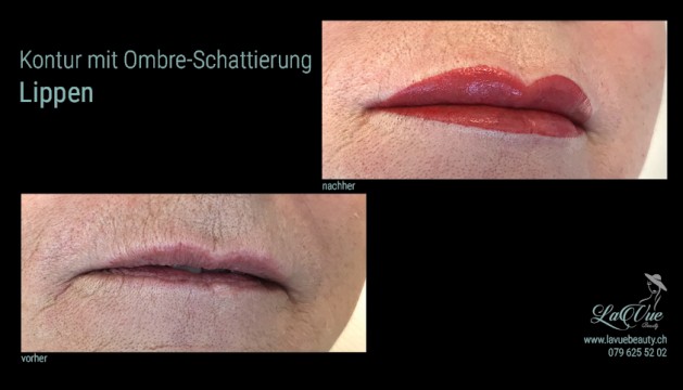 Lippen Kontur mit Ombre Schattierung Vorher Nachher Bild MICRONEEDLING PERMANENT MAKE-UP MICROBLADING BERN THUN