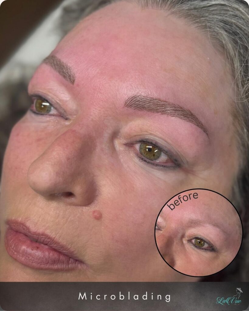 Auf dem Bild sieht man eine Frau mittleren alters, die auf einer Behandlungsliege bei Lavuebeauty Bern liegt, nach einer Microblading PMU Behandlung. Rechts unten sieht man, wie die Augenbrauen vorher aussahen.