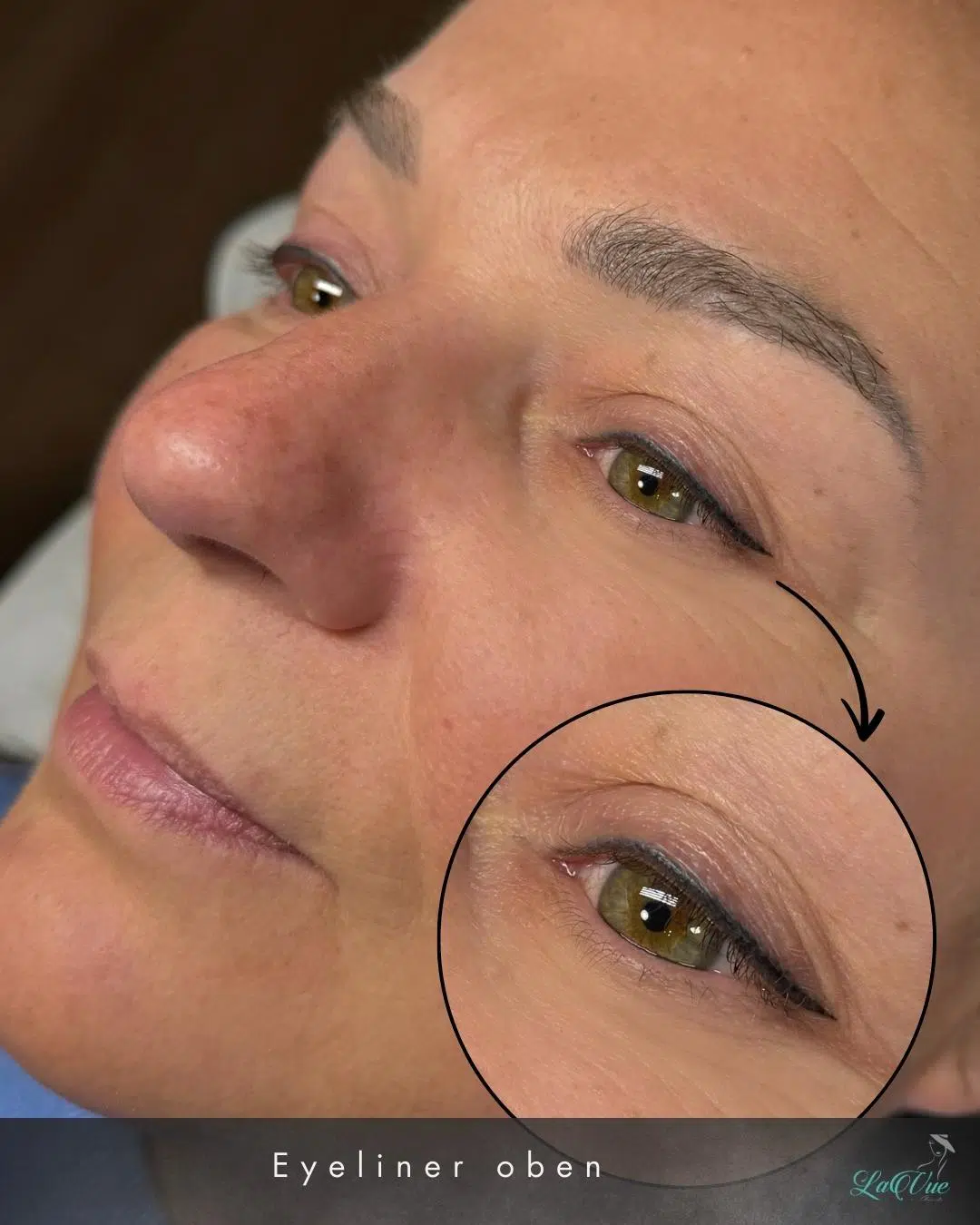 Eine Frau mittleren Alters nach einer PMU Eyeliner oben Behandlung. Liegt auf einer Liege und man sieht die behandelte Zone in einer Nahaufnahme